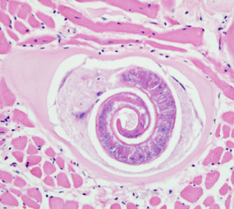 File:Trichinella rat BAM1.jpg