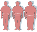 Thumbnail for File:Obesity-waist circumference.svg