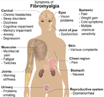 Symptoms of fibromyalgia