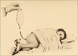 The diseases of infancy and childhood (1910) (14577515217).jpg