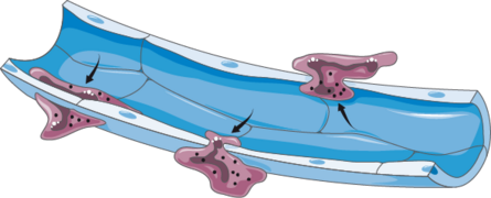 Cardiovascular system - Oedema 2 -- Smart-Servier.png