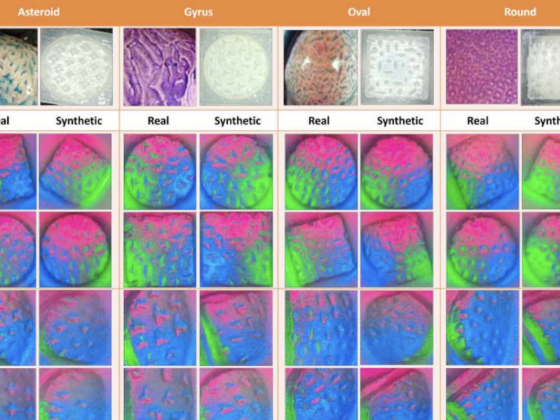 Synthetic images contrasted with the corresponding real textural images of four types of polyps