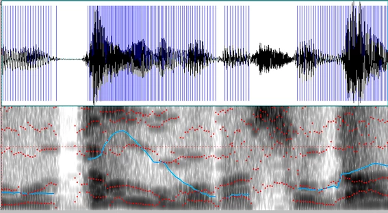 Composite image of audio waveform alongside spectrogram representation