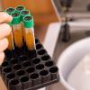 Hands shown placing vials into a centrifuge