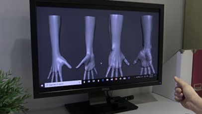 Images of hands in different positions shown on a monitor.