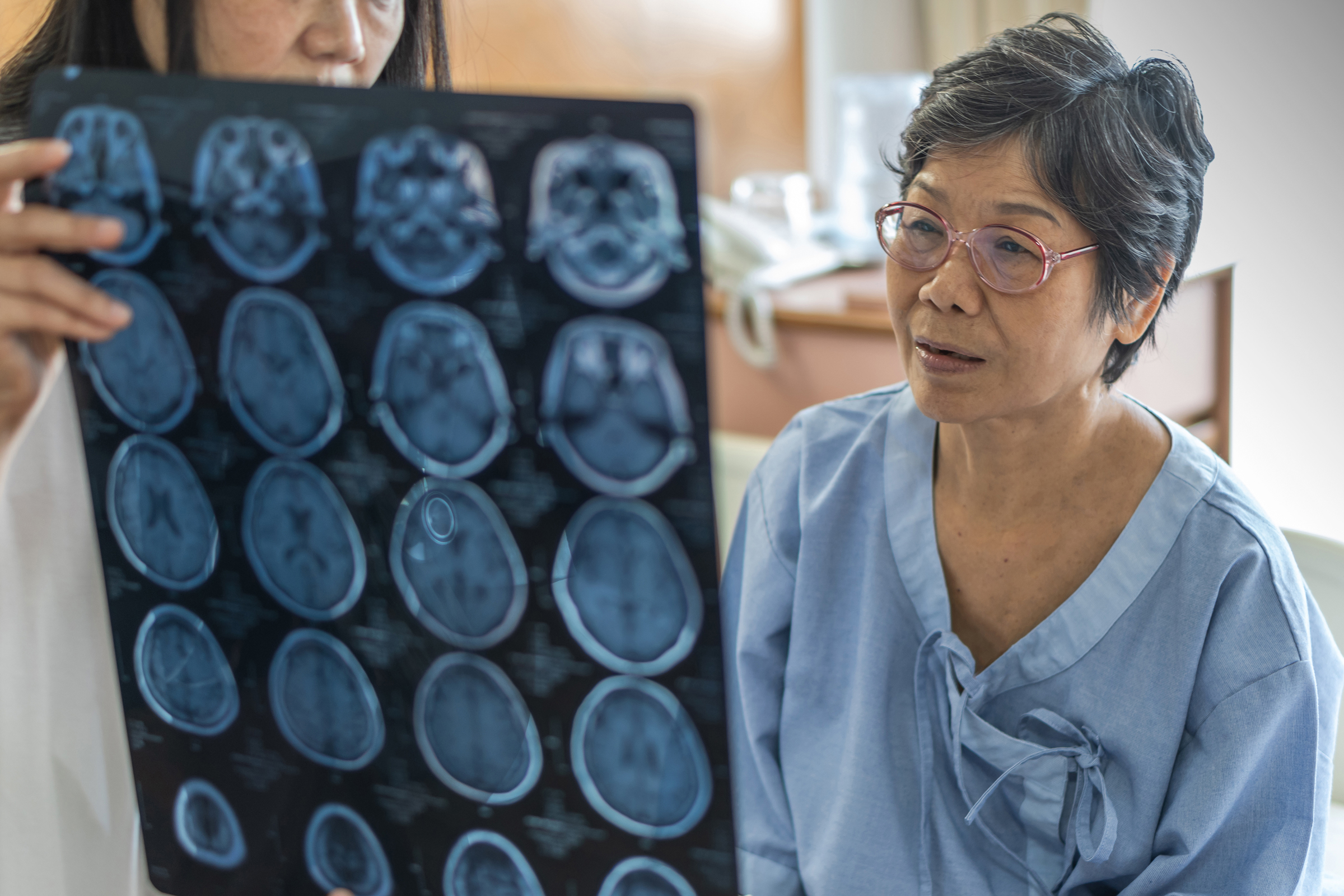 A doctor shows a brain scan image to a woman in a blue hospital gown