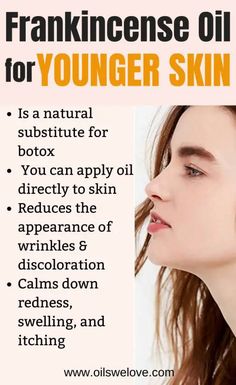 Discover these amazing benefits of Frankincense essential oil that is so great for your skin it is considered a natural botox. It helps to reduce the visibility of wrinkles, skin discoloration and reduce acne and acne scars. #Frankincense #essentialoil #skin #skincare #antiaging #acne Benefits Of Frankincense Essential Oil, Benefits Of Frankincense, Skin Care Procedures, Frankincense Benefits, Lotion For Oily Skin, Reduce Acne, Tips For Oily Skin, Health Cleanse