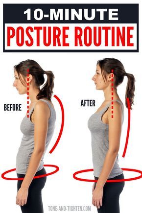 Upper Back Exercises At Home, How To Fix Lower Back Posture, How To Strengthen Your Upper Back, Exercise For Back Straight, Back Exercises Women Posture, Fix Upper Back Posture, How To Fix Upper Back Posture, Straighten Posture Exercise, Best Excersize For Back