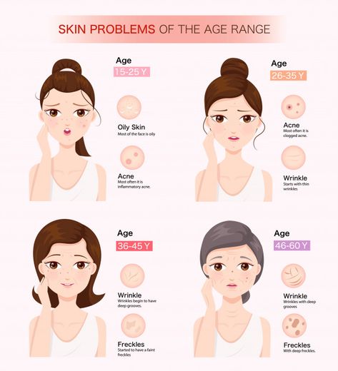 Skin problems of the age range Premium V... | Premium Vector #Freepik #vector #woman #cartoon #pink #beauty Skin Tips, Skin Therapist, Natural Acne Remedies, Acne Remedies, Skin Diseases, Skin Care Essentials, Skin Tightening, Skin Rejuvenation, Better Skin