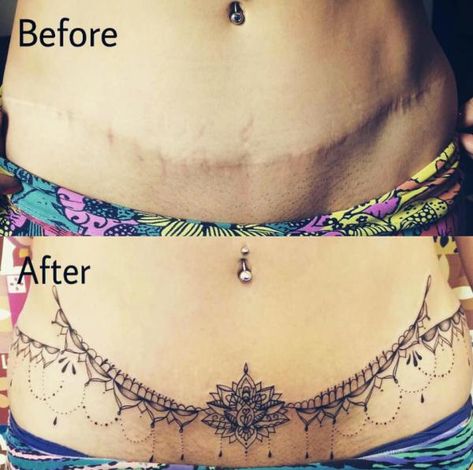 Tummy Tuck Tattoo: What You Need to Know | Art and Design Lower Stomach Tattoos For Women, Tattoos Classy, Lower Belly Tattoos, Abdomen Tattoo, Lower Stomach Tattoos, Tummy Tattoo, Tattoo Over Scar, Henne Tattoo, Stomach Tattoos Women