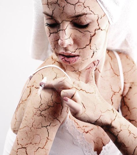 Dehydrated Skin: Causes, Symptoms, And How To Care For It Dry Skin Remedies, Skin Spots, Sinus Infection, Flaky Skin, Skin Remedies, Itchy Skin, Skin Issues, Dehydrated Skin, Tree Oil