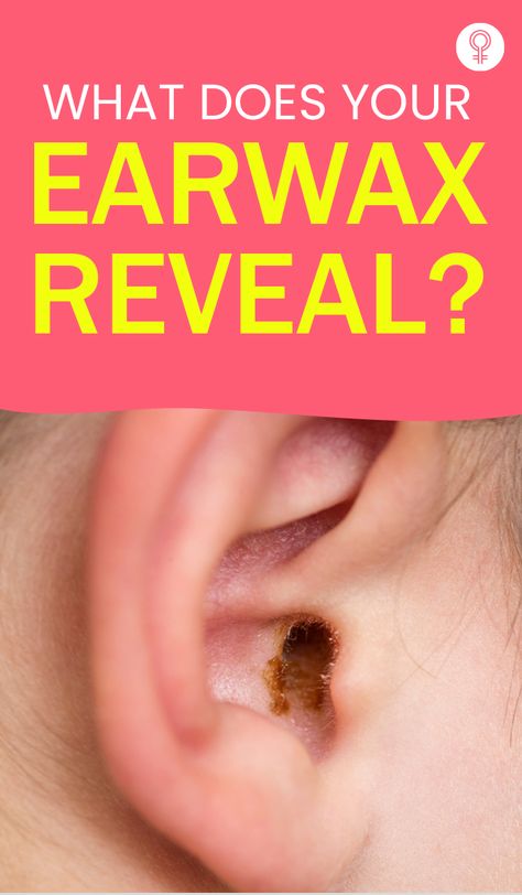 What Does Your Earwax Reveal? The color of the earwax varies from person to person and essentially speaks about the person’s genetic origin. It also shows the amount of secretions produced by the apocrine glands (the glands that secrete an oil-like substance to form earwax) and suggests the presence of a possible medical condition. #earwax #health #healthcare #healthtips Ear Wax Removal Video, Ear Hair Removal, Impacted Ear Wax, Outer Ear, Cleaning Your Ears, Ear Wax Removal, Color And Texture, Ear Cleaning, Dark Wax