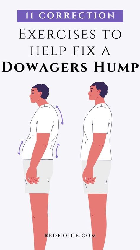 Improve your posture and minimize that dowager's hump with 11 stretches and exercises focused on correction and prevention. By strengthening your upper back while gently mobilizing tight areas around your neck and shoulders, these daily routines can help you achieve better alignment and reduce rounding in your upper back. Make these moves part of your regimen to get rid of that hump for good! Improve Posture Exercises, Hump Neck, Dowagers Hump, Neck Posture, Dowager's Hump, Posture Stretches, Better Posture Exercises, Forward Head Posture Exercises, Posture Correction Exercises