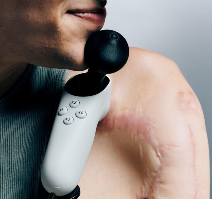 Person holding an Xbox Adaptive Joystick between their chin and shoulder