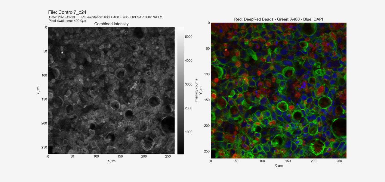 PicoQuant-multi_channel_screen