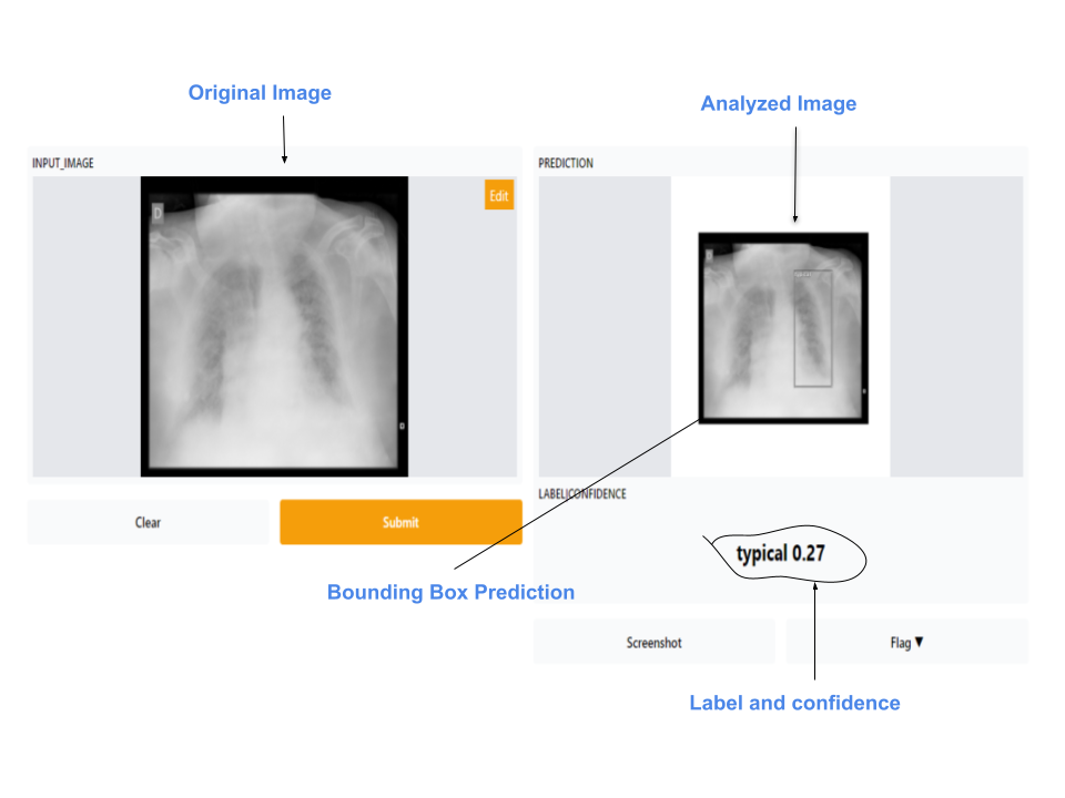 app-pneumonia-detection